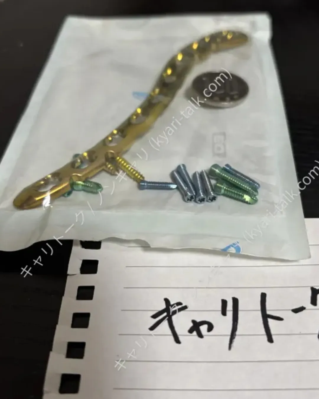 鎖骨から摘出されたチタンプレート